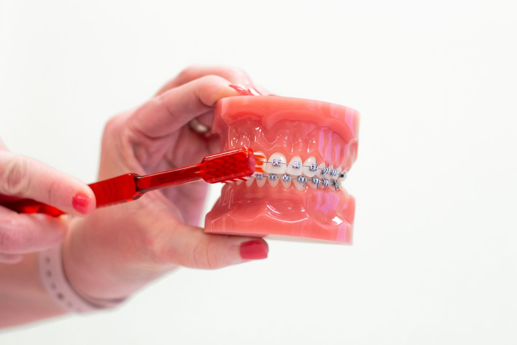 orthodontics austin