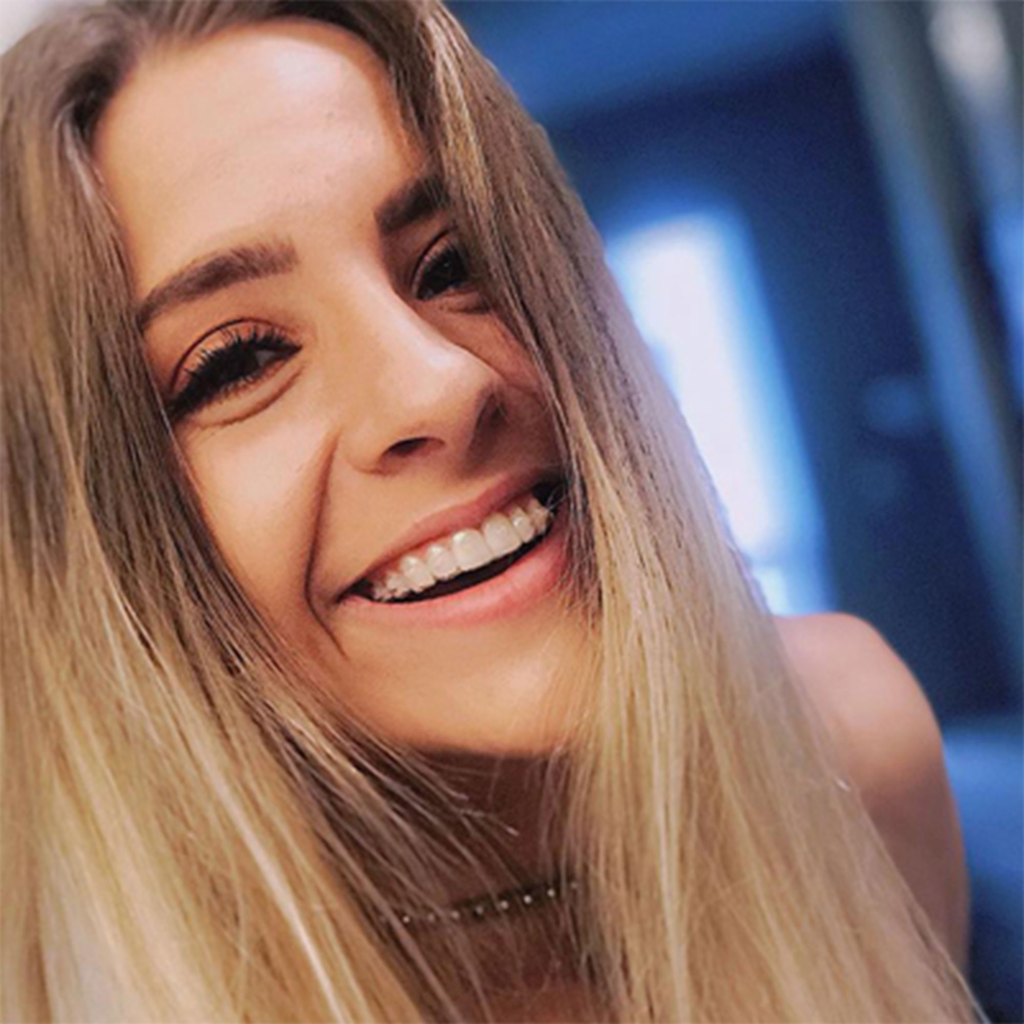 Clear aligners on plastic model