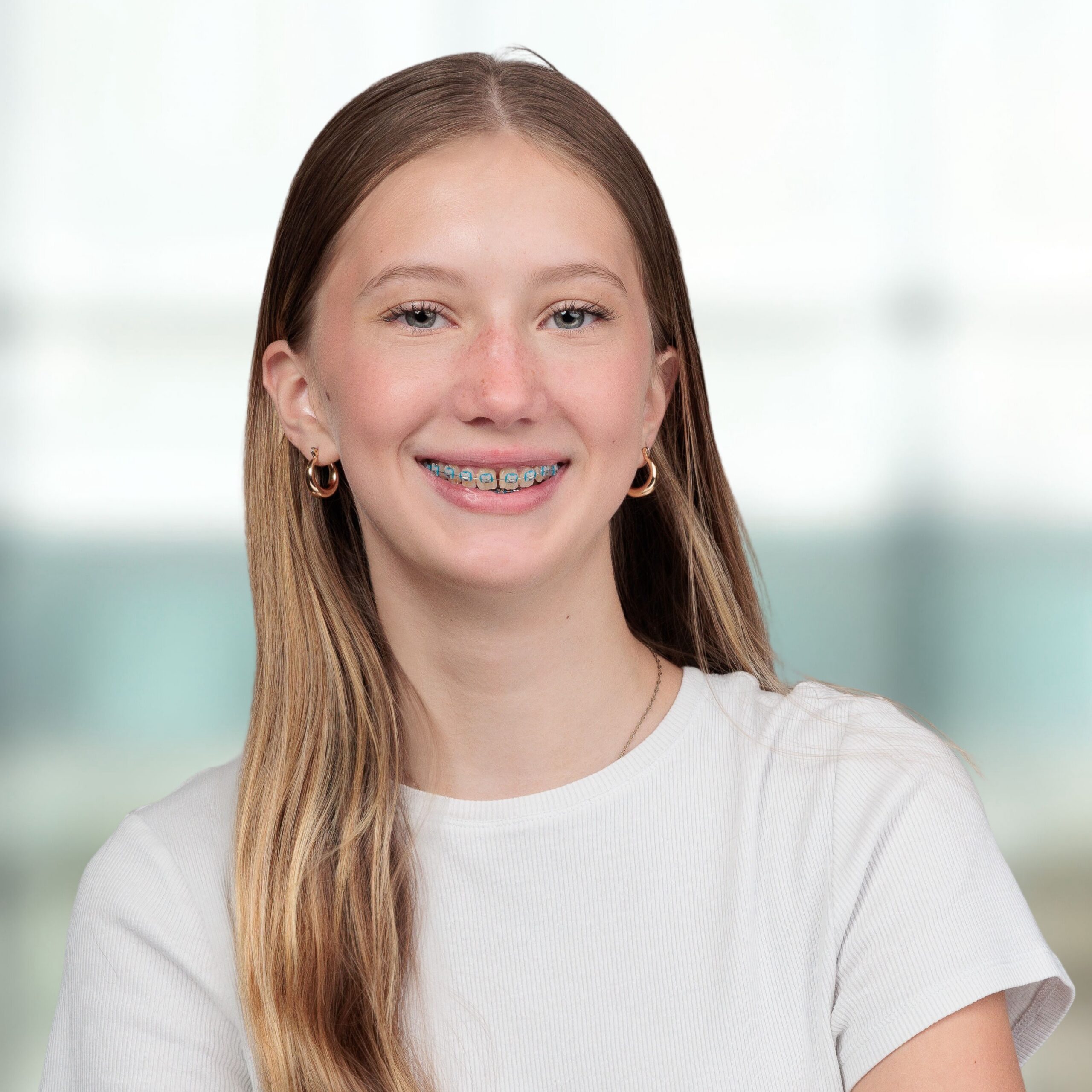 clear braces on plastic model