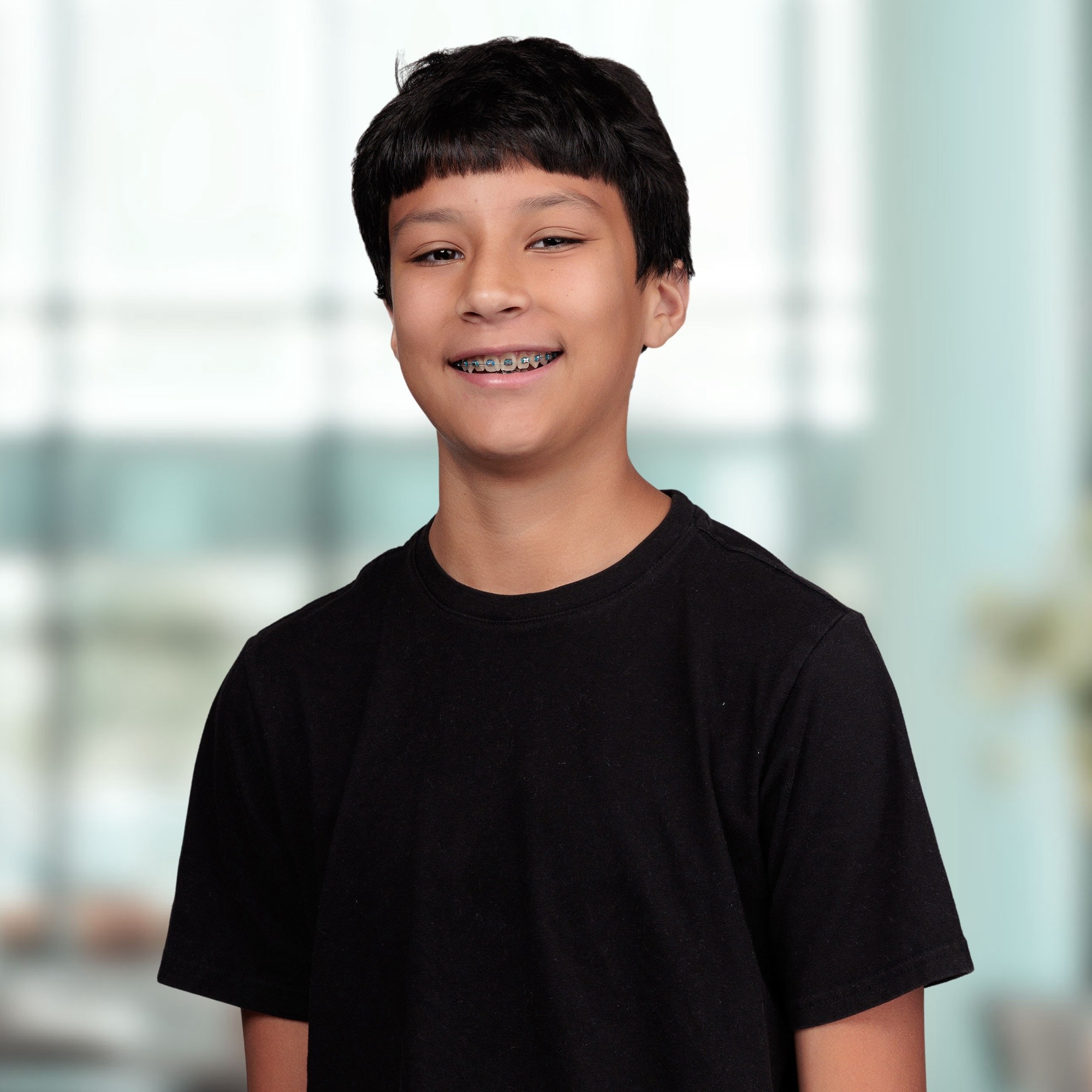 metal braces on plastic model